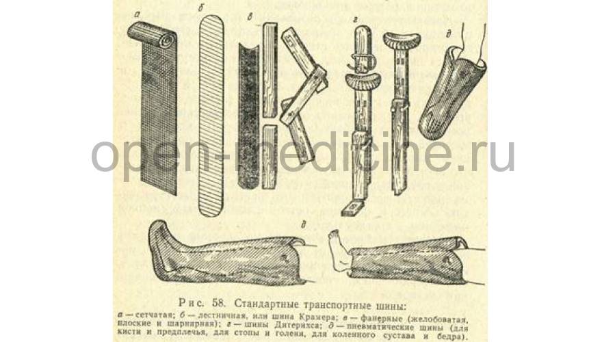 Шинные повязки. Правила наложения транспортных шин. Шинные повязки. Правила наложения транспортных шин.